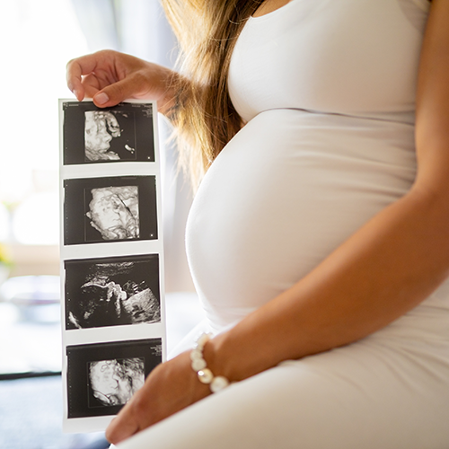 woman-with-ultrasound Pregant woman holding an ultrasound of her unborn child